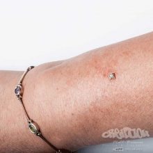 wrist microdermal piercing by Matt Bressmer